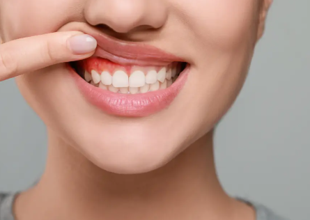 Get Your Confidence Back Fast: A Guide to Same-Day Smile Restoration